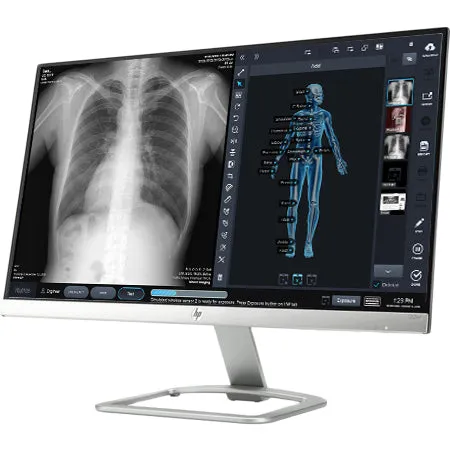 ControlX Z-MOTION Digital X-ray System