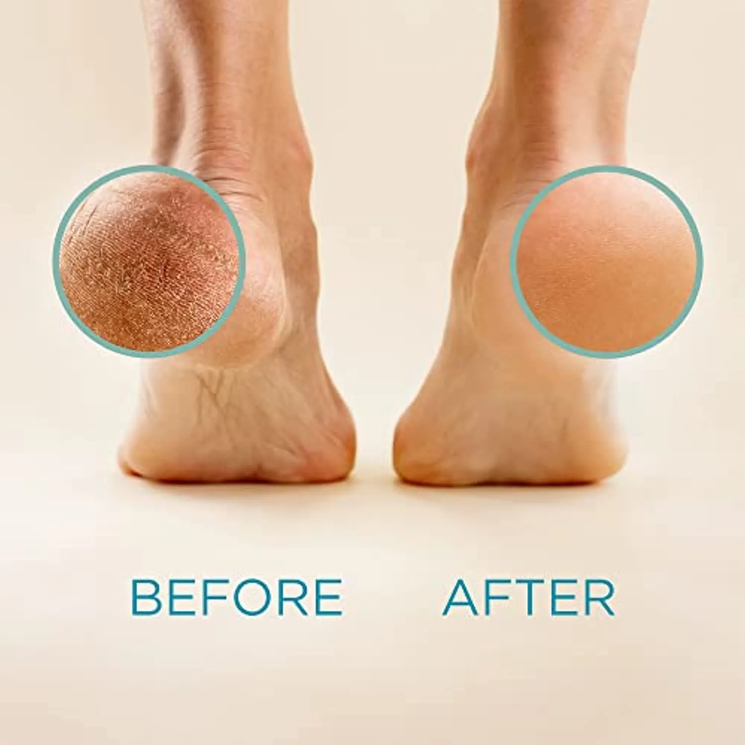 Lee Beauty Professional Callus Remover Extra Strength Gel for Feet, at Home Pedicure Results, 8 Oz